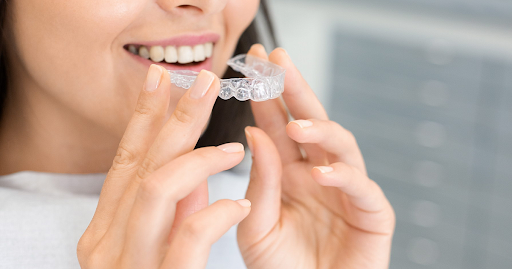 A Complete Guide: What to Know Before Starting Smile Aligner Treatment